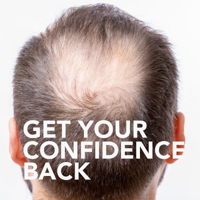 Member's Mark Minoxidil 5%, Hair Regrowth Treatment for Men (2 fl. oz., 6  ct.) - Sam's Club